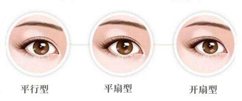 做完眼袋内切眼睛有异物感正常吗？含缓解妙招+需警惕的异常信号