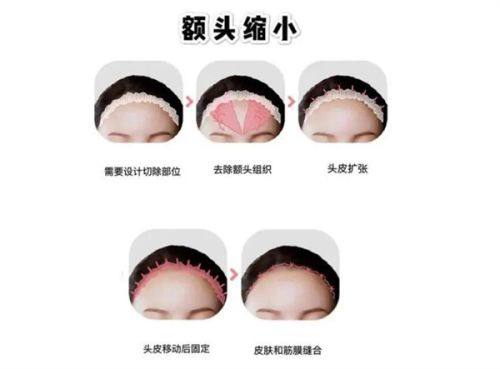 四、凡士林加维生素e能去眼袋吗