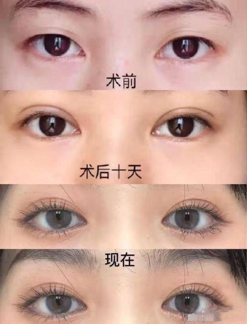 黄石第四 医院美容科医生名单及擅长领域：