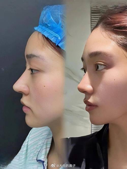 深圳盛美佳门诊部美容科擅长项目：