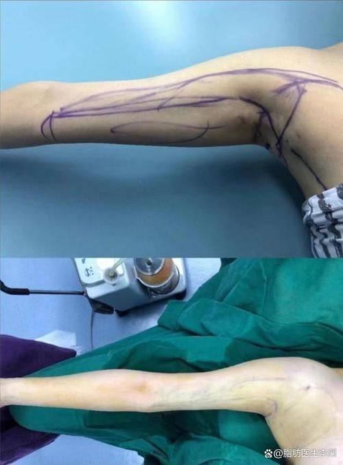 深圳盛美佳门诊部美容科口碑评价