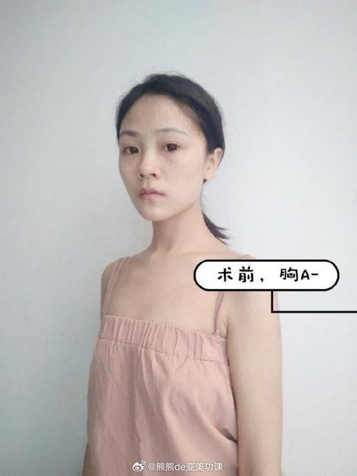 济宁玉烨汇美医疗美容诊所怎么样？