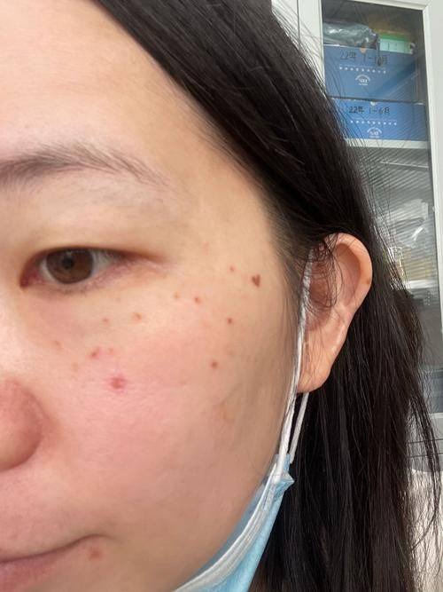 葫芦岛华美医疗美容门诊部擅长项目：