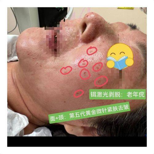 武汉艾薇医疗美容门诊部价格表