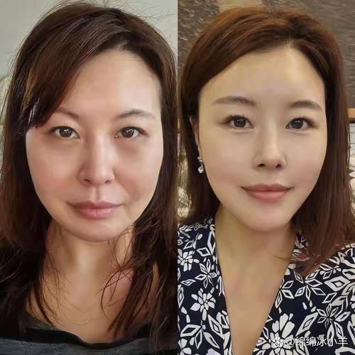 深圳盛美佳门诊部美容科预约挂号方式