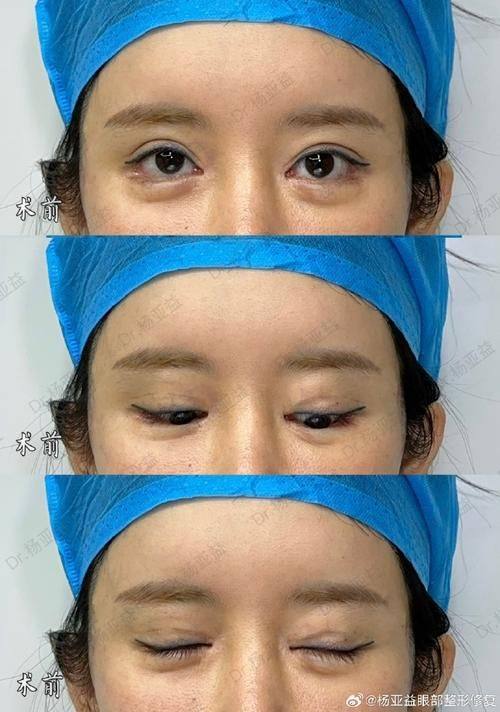 济宁玉烨汇美医疗美容诊所预约挂号方式：