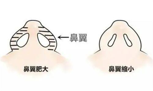 三、眼袋复发的常见诱因