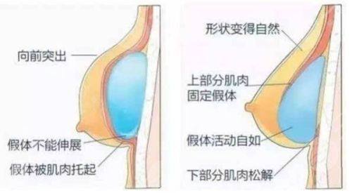 二、这些情况建议超肋隆鼻结合耳软骨