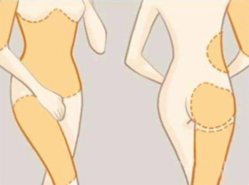 五、30岁女人去眼袋更好的办法？