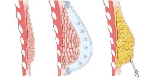 二、日常护理:轻度细纹改善与预防的核心