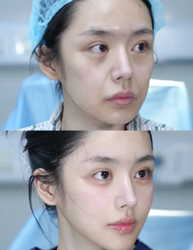 五、修复手术的术前术后注意事项:保护成效更省心