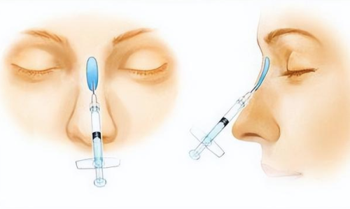 三、靠谱医生及手术成效实例