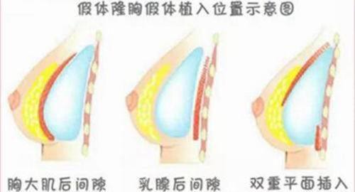 四、热敷去眼袋的适用人群与禁忌红线