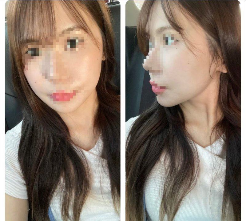 五、术前术后关键注意点