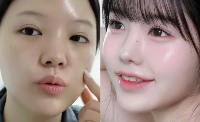 三、腹部吸脂的塑形优势:不止平坦,更有线条感