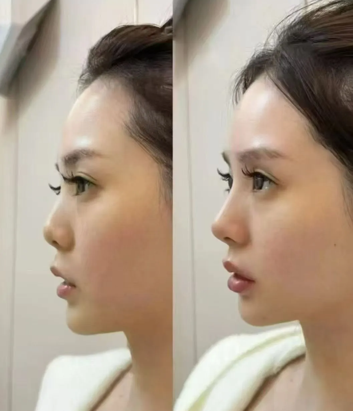 二、疤痕增生期的饮食宜忌:吃什么能抑制疤痕增生