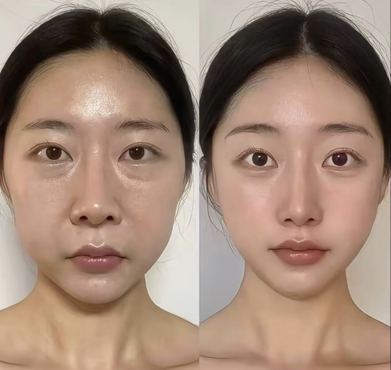 四、白毒瘦脸针的维持时间有多久