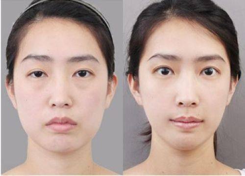 保定定州桃夭医疗美容诊所地址电话及营业时间: