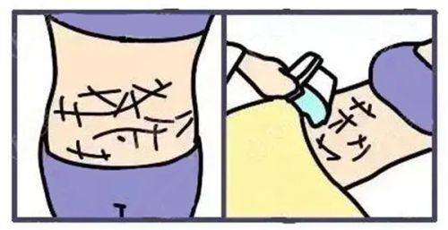 四、价格差异背后的价值:高价手术到底值在哪?