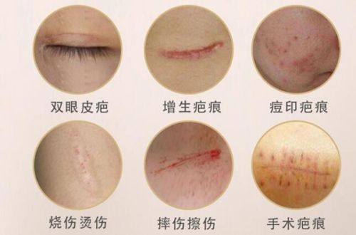 二、别再纠结“什么牌子的眼霜去眼袋成效更好”，先认清眼袋的本质