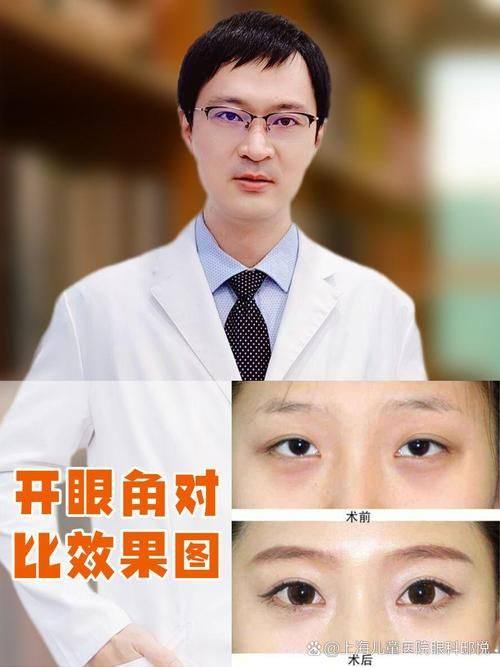 北京李沁奕华意脂肪体雕中 心地址电话及营业时间: