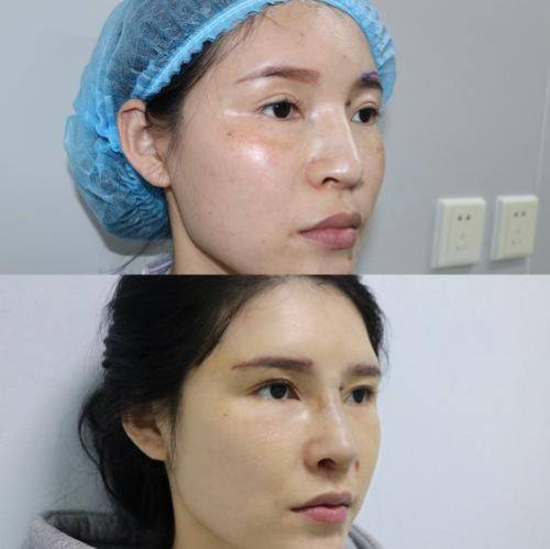 成都轻安美育整形医院怎么样?