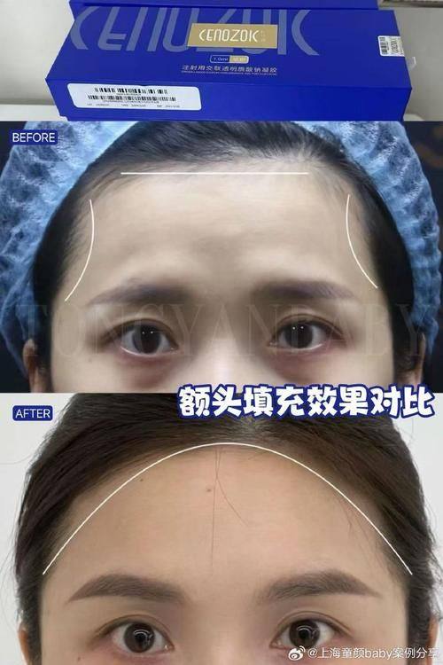 吉林尹学华医疗美容门诊部价格表