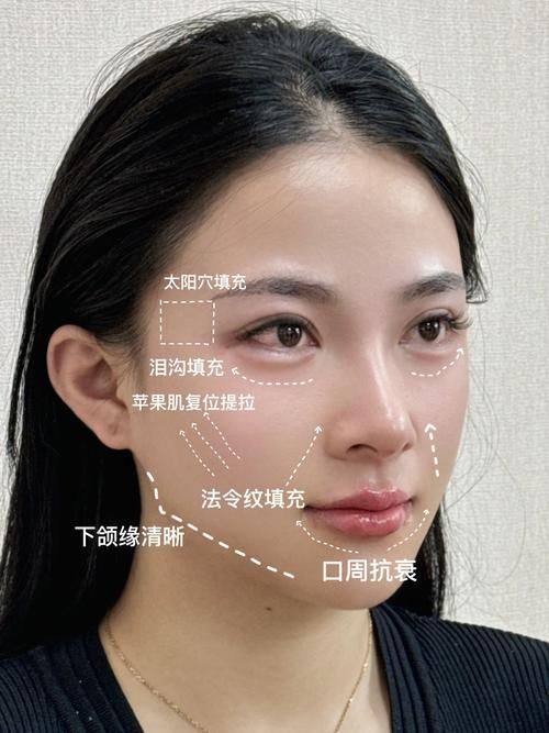 北京李沁奕华意脂肪体雕中 心预约挂号方式: