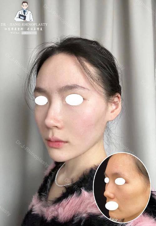 吉林尹学华医疗美容门诊部擅长项目：