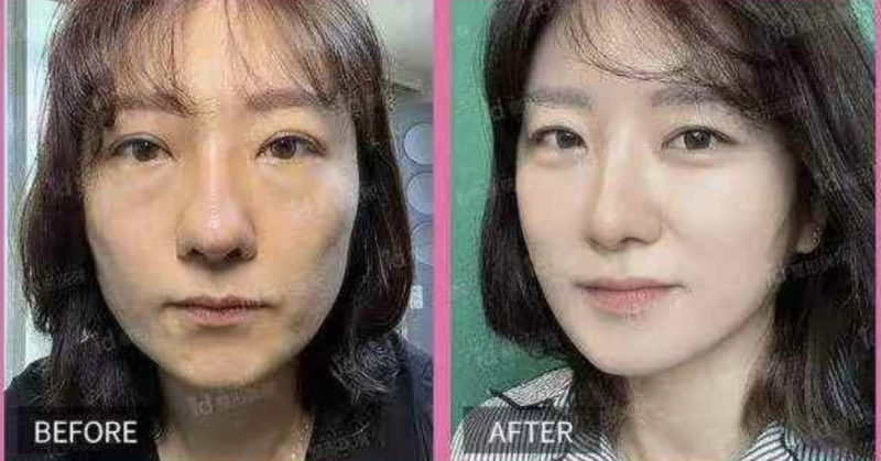 五、视觉错觉与组织自然变化:容易被混淆的“假性复发”