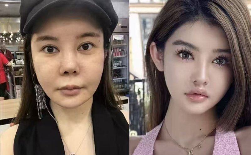 四、十五岁女生鼻部美观的安心替代方案