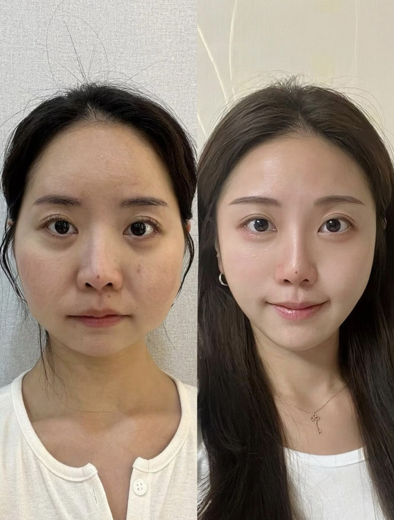 东莞吉美中科整形医院擅长项目