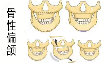 五、消肿慢的应对与误区规避