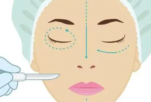 昆明亨川整形医院口碑评价：