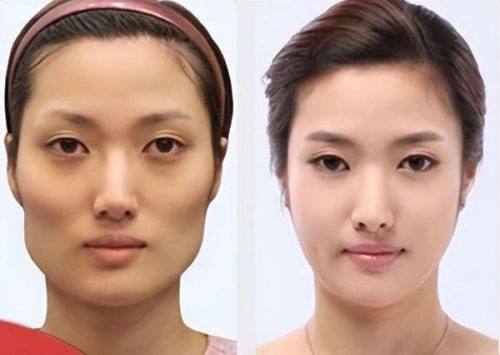 四、注射完瘦脸针的饮食护理要点