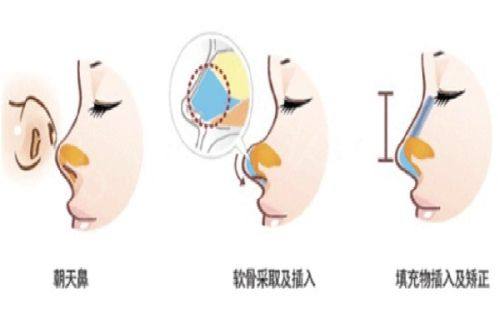 三、注射完瘦脸针的运动与清洁护理指南
