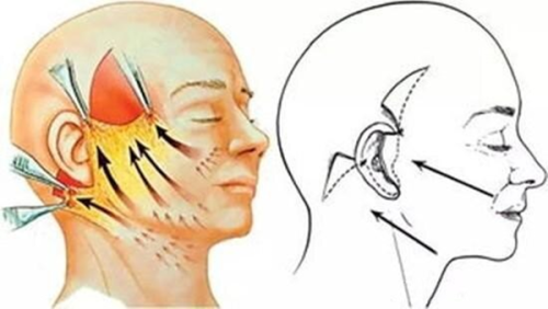 五、鼻梁疤痕修复手术一般多少钱