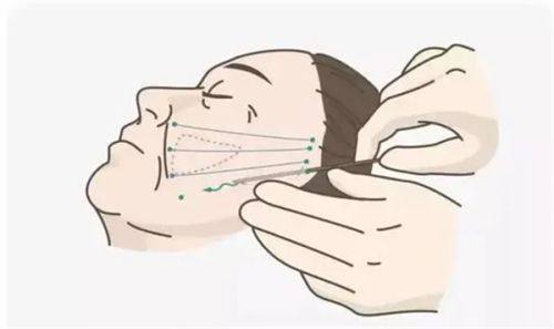 四、科学用药：中西结合提速消肿
