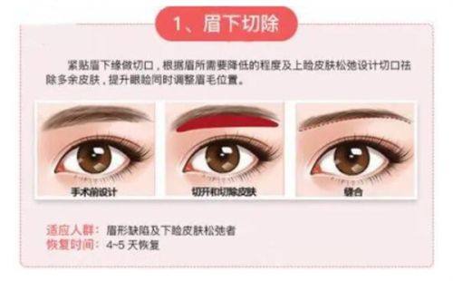 六、临床实例：自律让抽脂成效更持久