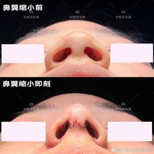 国内石油天然气集团公司中 心医院整形手外科预约挂号方式: