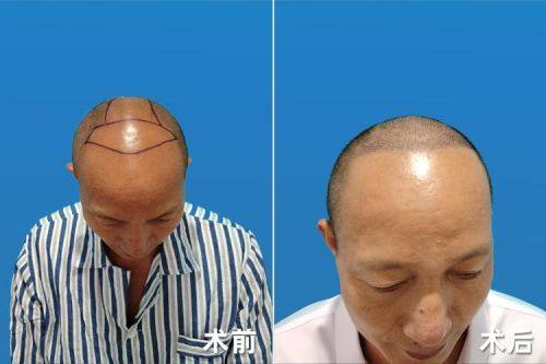 国内石油天然气集团公司中 心医院整形手外科口碑评价: