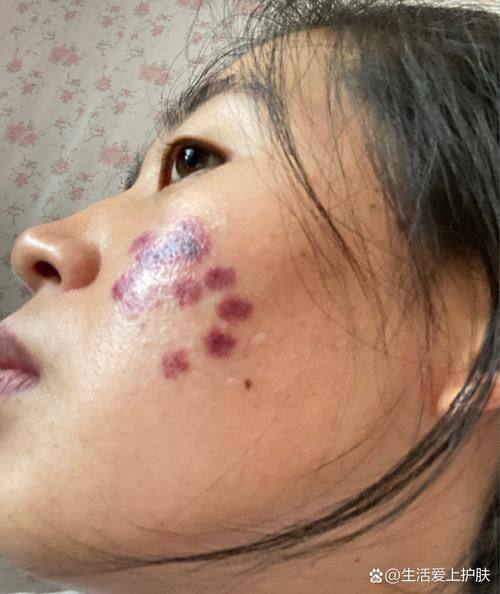 太和县人民医院(烧伤整形科)地址电话及营业时间