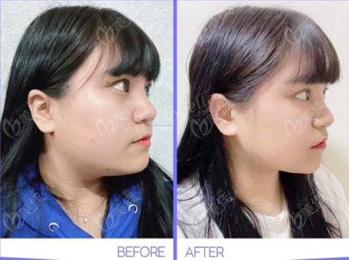 青岛多丽迎整形医疗美容诊所预约挂号方式