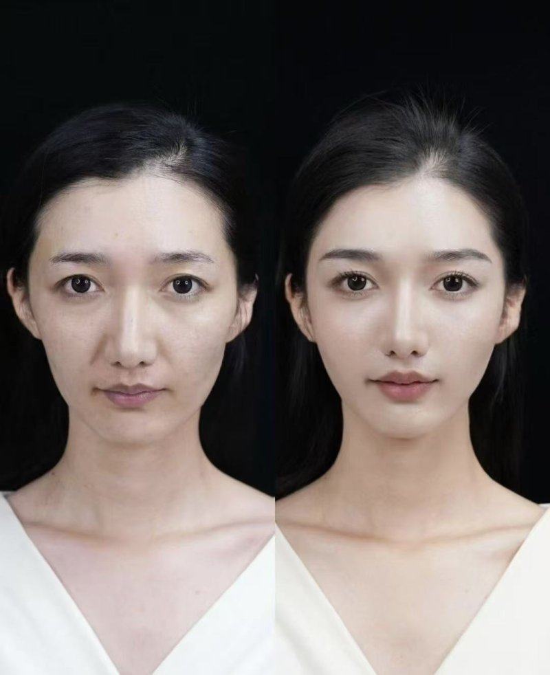 关于烫伤疤痕修复的重要提醒