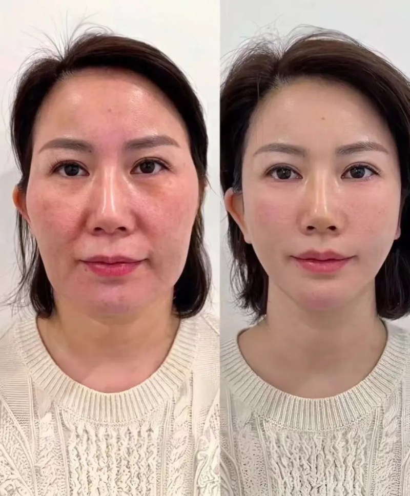 国内外正规烫伤疤痕修复机构参考