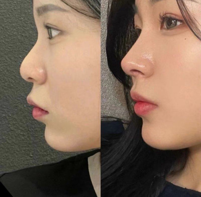 昆明亨川整形医院预约挂号方式：