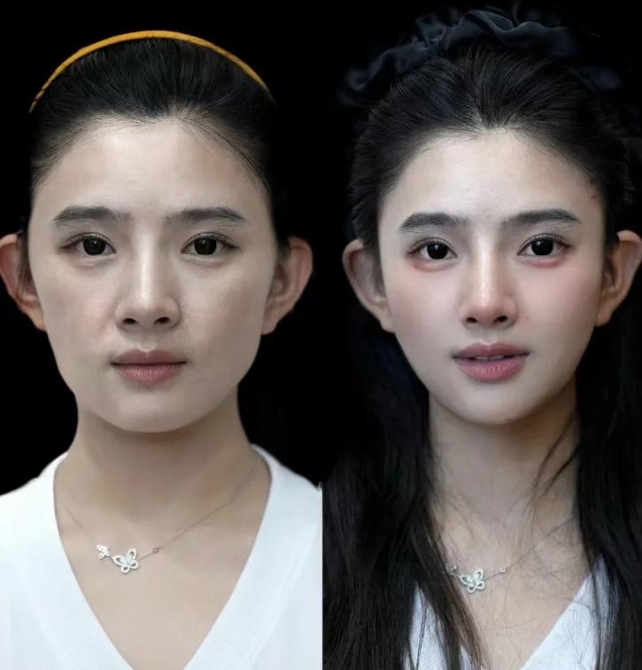 被烫伤的疤痕怎么祛除？方案与机构全解析，新旧增生儿童疤针对性修复