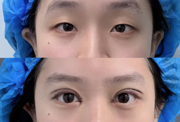 五、疤痕发白的日常调理小妙招