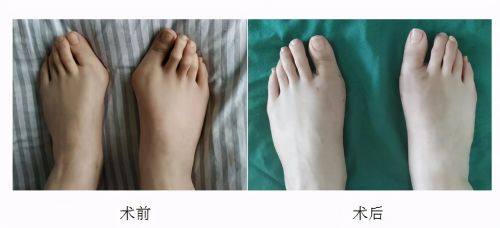 无锡康洹整形医院价格表：