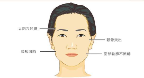 五、男生去眼袋避坑指南：这些细节别忽略